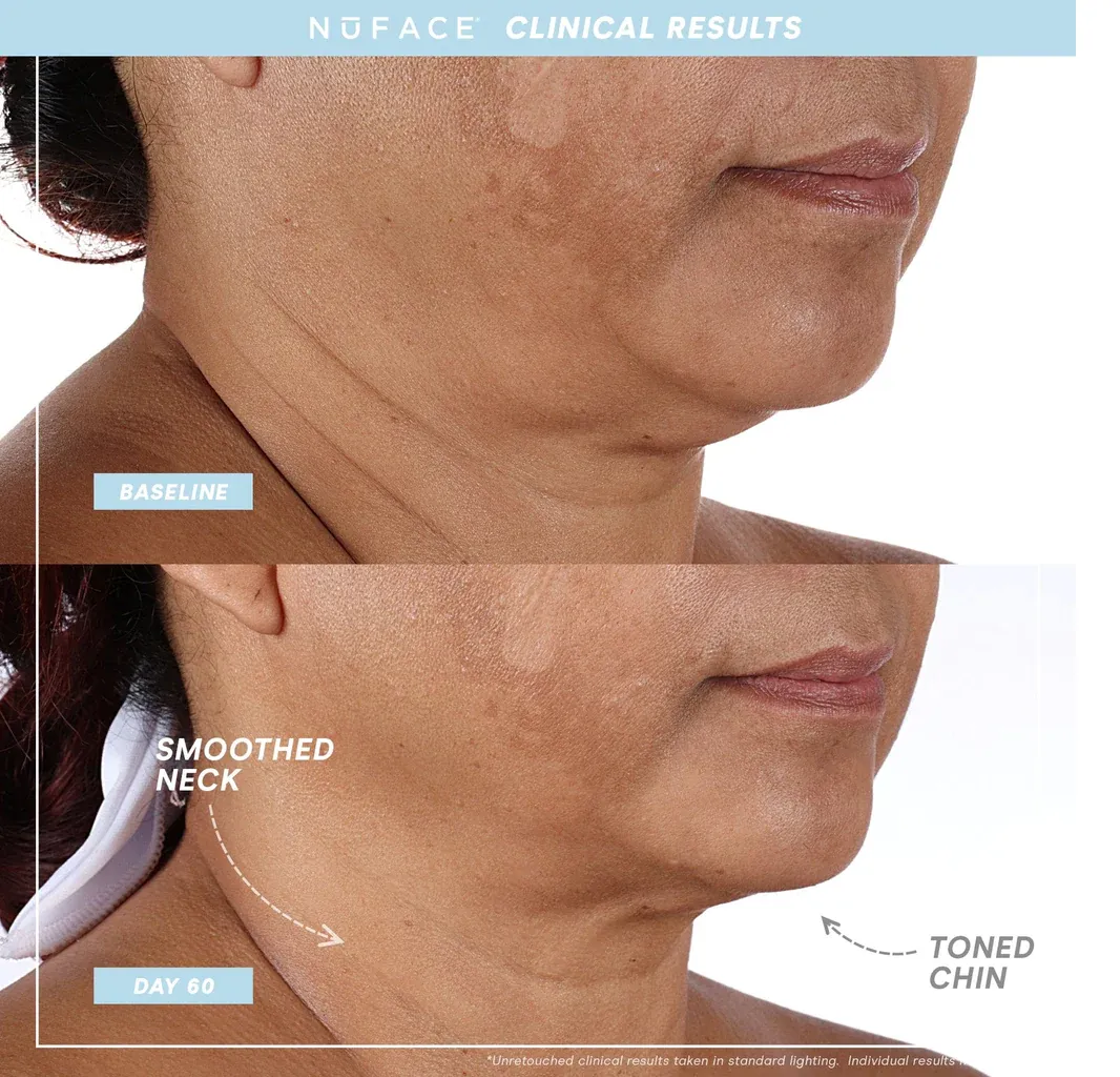 NuFACE MINI   Starter Kit